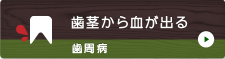 歯茎から血が出る 歯周病