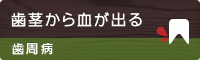 歯茎から血が出る 歯周病